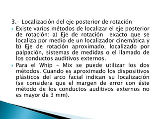 3.- Localización del eje posterior de rotación
 Existe varios métodos de localizar el eje posterior
de rotación: a) Eje de rotación exacto que se
localiza por medio de un localizador cinemática y
b) Eje de rotación aproximado, localizado por
palpación, sistemas de medidas o el llamado de
los conductos auditivos externos.
 Para el Whip – Mix se puede utilizar los dos
métodos. Cuando es aproximado los dispositivos
plásticos del arco facial indican su localización
(se considera que el margen de error con éste
método de los conductos auditivos externos no
es mayor de 3 mm).
 