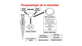 Fisiopatología de la obesidad
 