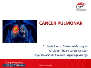 www.usat.edu.pe
www.usat.edu.pe
Dr. Jesús Alonso Custodio Marroquín
Cirujano Tórax y Cardiovascular
Hospital Nacional Almanzor Aguinaga Asenjo
CÁNCER PULMONAR
 