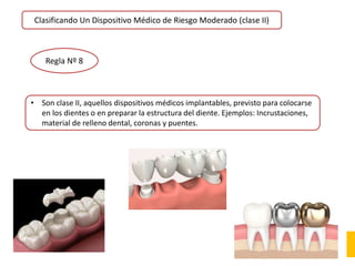 Clasificando Un Dispositivo Médico de Riesgo Moderado (clase II)
Regla Nº 8
• Son clase II, aquellos dispositivos médicos implantables, previsto para colocarse
en los dientes o en preparar la estructura del diente. Ejemplos: Incrustaciones,
material de relleno dental, coronas y puentes.
 