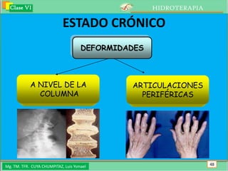 Clase VI                                          HIDROTERAPIA

                            ESTADO CRÓNICO
                                     DEFORMIDADES



            A NIVEL DE LA                     ARTICULACIONES
              COLUMNA                           PERIFÉRICAS




Mg. TM. TFR. CUYA CHUMPITAZ, Luis Ysmael                           48
 