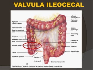VALVULA ILEOCECAL
 