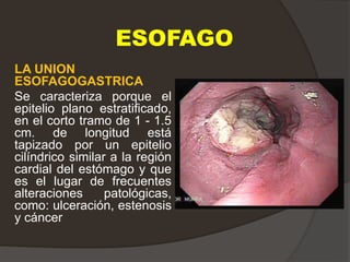 ESOFAGO
LA UNION
ESOFAGOGASTRICA
Se caracteriza porque el
epitelio plano estratificado,
en el corto tramo de 1 - 1.5
cm. de longitud está
tapizado por un epitelio
cilíndrico similar a la región
cardial del estómago y que
es el lugar de frecuentes
alteraciones patológicas,
como: ulceración, estenosis
y cáncer
 