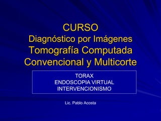 CURSO
Diagnóstico por Imágenes
Tomografía Computada
Convencional y Multicorte
Lic. Pablo Acosta
TORAX
ENDOSCOPIA VIRTUAL
INTERVENCIONISMO
 