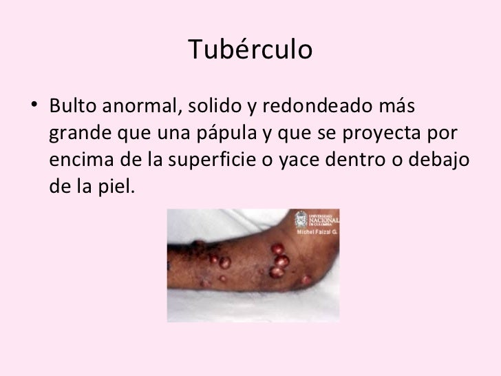 Clase 7 lesiones de la piel