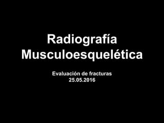 Radiografía
Musculoesquelética
Evaluación de fracturas
25.05.2016
 