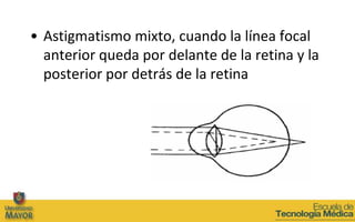 Clase 7b (astigmatismo)