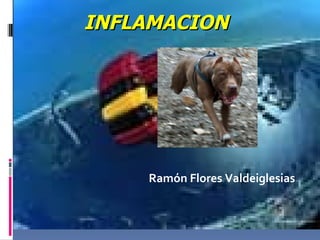 INFLAMACION




    Ramón Flores Valdeiglesias
 