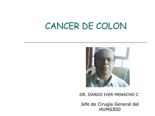 CANCER DE COLON
Jefe de Cirugía General del
HUMSJDD
DR. DARDO IVER MENACHO C
 