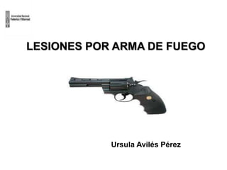 LESIONES POR ARMA DE FUEGO
Ursula Avilés Pérez
 