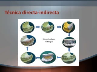Técnica directa-indirecta
 