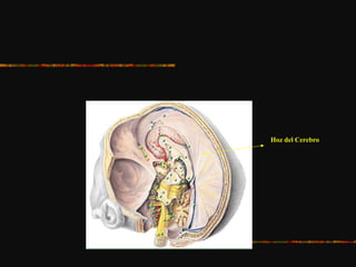Hoz del Cerebro
 
