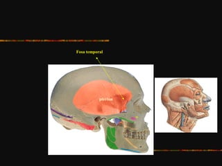 Fosa temporal
pterion
 