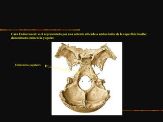 Cara Endocraneal: está representada por una saliente ubicada a ambos lados de la superficie basilar,
denominada eminencia yugular.
Eminencias yugulares
 