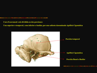 Cara Exocraneal: está dividida en dos porciones:
Una superior o temporal y una inferior o basilar, por una saliente denominada Apófisis Cigomática
Porción temporal
Apófisis Cigomática
Porción Basal o Basilar
 