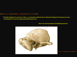 Porción temporal: es convexa y lisa, y se encuentra cubierta por el músculo Temporal. Presenta un surco
vertical para la Arteria temporal profunda posterior
Surco de arteria temporal profunda posterior
 