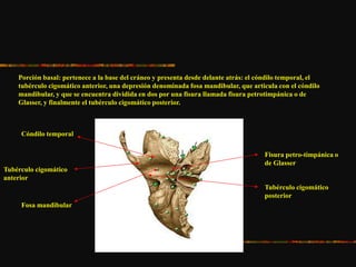 Porción basal: pertenece a la base del cráneo y presenta desde delante atrás: el cóndilo temporal, el
tubérculo cigomático anterior, una depresión denominada fosa mandibular, que articula con el cóndilo
mandibular, y que se encuentra dividida en dos por una fisura llamada fisura petrotimpánica o de
Glasser, y finalmente el tubérculo cigomático posterior.
Cóndilo temporal
Tubérculo cigomático
anterior
Fosa mandibular
Fisura petro-timpánica o
de Glasser
Tubérculo cigomático
posterior
 