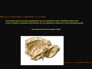 Cara Endocraneal: presenta irregularidades que corresponden al apoyo del lóbulo temporal del
cerebro. Además se encuentra recorrida por un surco dejado por el paso de la arteria meníngea media
Surco para la arteria meníngea media
 