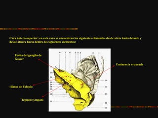 Cara ántero-superior: en esta cara se encuentran los siguientes elementos desde atrás hacia delante y
desde afuera hacia dentro los siguientes elementos:
Eminencia arqueada
Hiatos de Falopio
Fosita del ganglio de
Gasser
Tegmen tympani
 