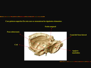 Cara póstero-superior:En esta cara se encuentran los siguientes elementos:
CAI
Fosa subarcuata
Fosita ungueal
Canal del Seno lateral
Agujero
mastoideo
 