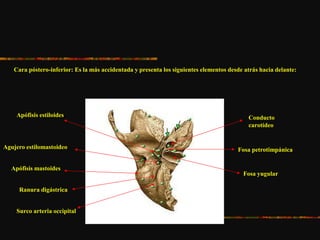 Cara póstero-inferior: Es la más accidentada y presenta los siguientes elementos desde atrás hacia delante:
Apófisis mastoides
Ranura digástrica
Surco arteria occipital
Apófisis estiloides
Agujero estilomastoideo
Fosa yugular
Conducto
carotídeo
Fosa petrotimpánica
 