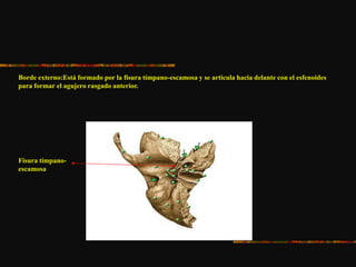Borde externo:Está formado por la fisura tímpano-escamosa y se articula hacia delante con el esfenoides
para formar el agujero rasgado anterior.
Fisura tímpano-
escamosa
 
