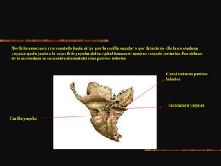Borde interno: está representado hacia atrás por la carilla yugular y por delante de ella la escotadura
yugular quién junto a la superficie yugular del occipital forman el agujero rasgado posterior. Por delante
de la escotadura se encuentra el canal del seno petroso inferior
Carilla yugular
Escotadura yugular
Canal del seno petroso
inferior
 
