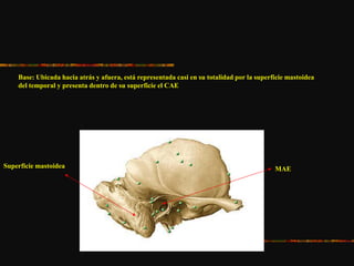 Base: Ubicada hacia atrás y afuera, está representada casi en su totalidad por la superficie mastoidea
del temporal y presenta dentro de su superficie el CAE
Superficie mastoidea MAE
 