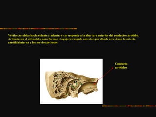 Vértice: se ubica hacia delante y adentro y corresponde a la abertura anterior del conducto carotídeo.
Articula con el esfenoides para formar el agujero rasgado anterior, por dónde atraviesan la arteria
carótida interna y los nervios petrosos
Conducto
carotídeo
 