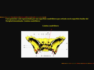 Cara posterior: está representada por una superficie cuadrilátera que articula con la superficie basilar del
Occipital denominada: Lámina cuadrilátera
Lámina cuadrilátera
 