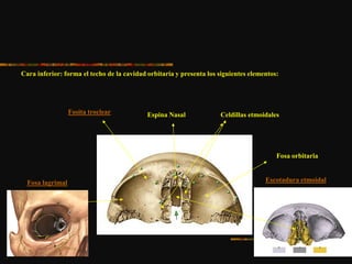 Cara inferior: forma el techo de la cavidad orbitaria y presenta los siguientes elementos:
Escotadura etmoidal
Espina Nasal Celdillas etmoidales
Fosa orbitaria
Fosa lagrimal
Fosita troclear
 