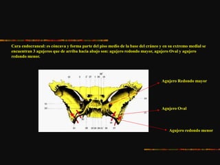 Cara endocraneal: es cóncava y forma parte del piso medio de la base del cráneo y en su extremo medial se
encuentran 3 agujeros que de arriba hacia abajo son: agujero redondo mayor, agujero Oval y agujero
redondo menor.
Agujero Redondo mayor
Agujero Oval
Agujero redondo menor
 