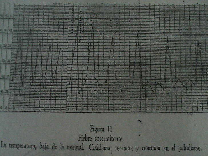 oscilacion temperatura corporal clase 8 a temperatura corporal fiebre urp oscilacion temperatura corporal clase 8 a temperatura corporal fiebre urp