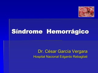 Síndrome Hemorrágico


        Dr. César García Vergara
     Hospital Nacional Edgardo Rebagliati
 