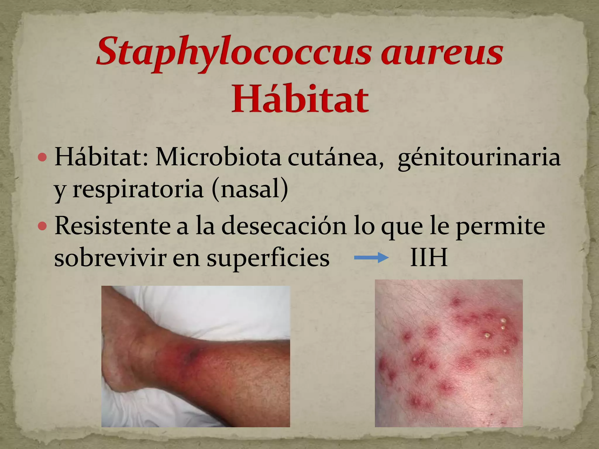  Hábitat: Microbiota cutánea, génitourinaria
  y respiratoria (nasal)
 Resistente a la desecación lo que le permite
  sobrevivir en superficies       IIH
 