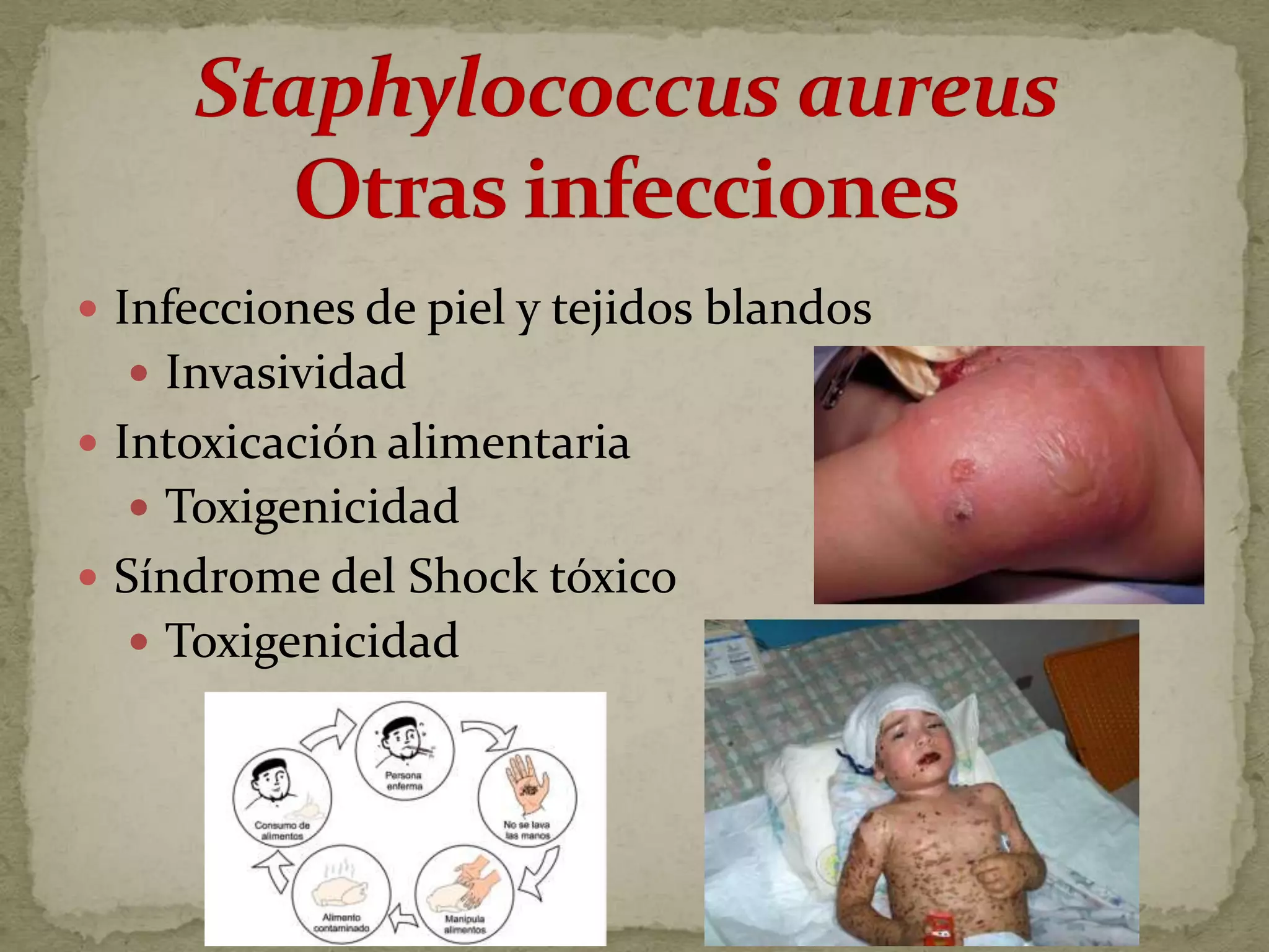  Infecciones de piel y tejidos blandos
   Invasividad
 Intoxicación alimentaria
   Toxigenicidad
 Síndrome del Shock tóxico
   Toxigenicidad
 