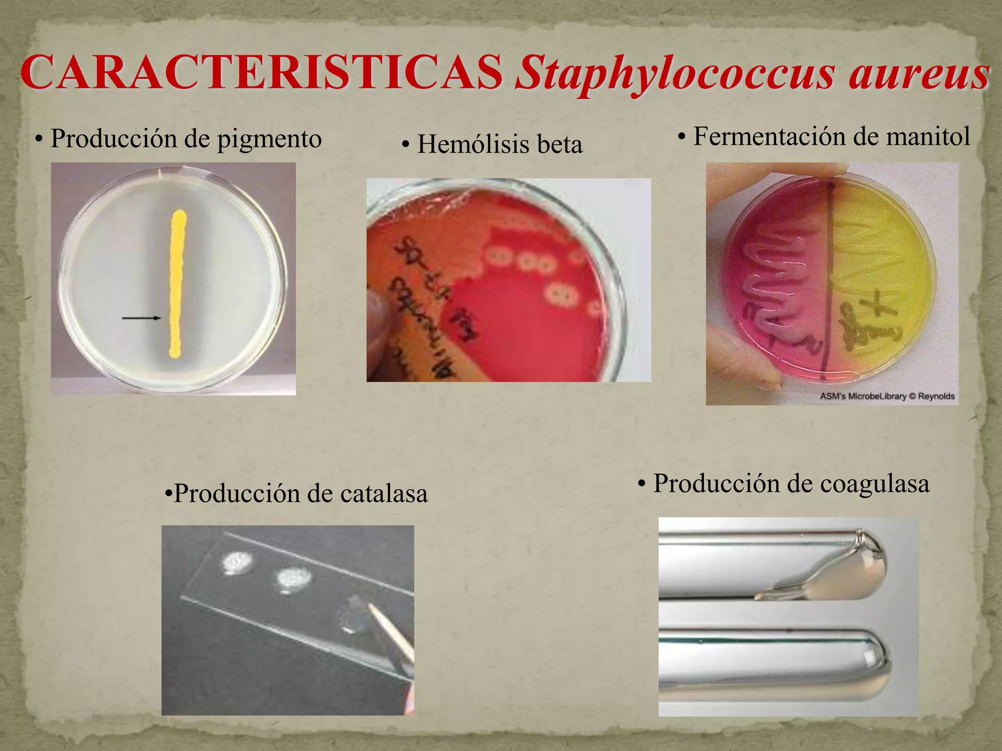 CARACTERISTICAS Staphylococcus aureus
• Producción de pigmento      • Hemólisis beta      • Fermentación de manitol




          •Producción de catalasa                • Producción de coagulasa
 
