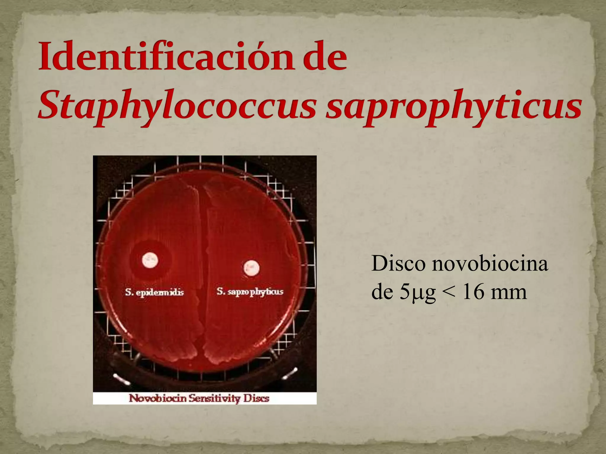 Disco novobiocina
de 5 g < 16 mm
 