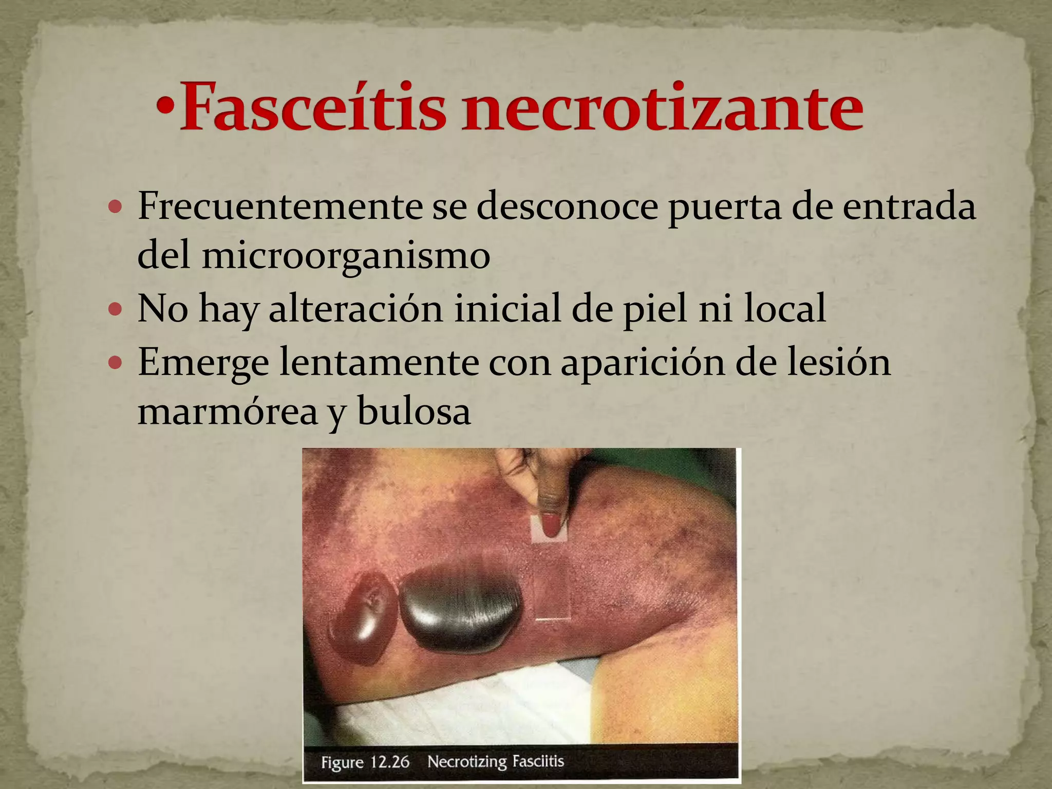  Frecuentemente se desconoce puerta de entrada
  del microorganismo
 No hay alteración inicial de piel ni local
 Emerge lentamente con aparición de lesión
  marmórea y bulosa
 