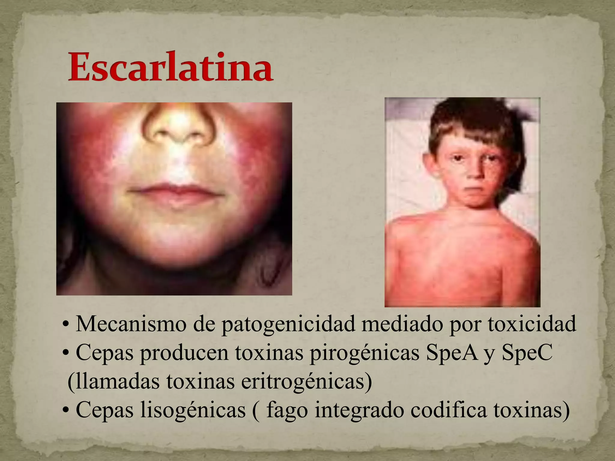 • Mecanismo de patogenicidad mediado por toxicidad
• Cepas producen toxinas pirogénicas SpeA y SpeC
 (llamadas toxinas eritrogénicas)
• Cepas lisogénicas ( fago integrado codifica toxinas)
 