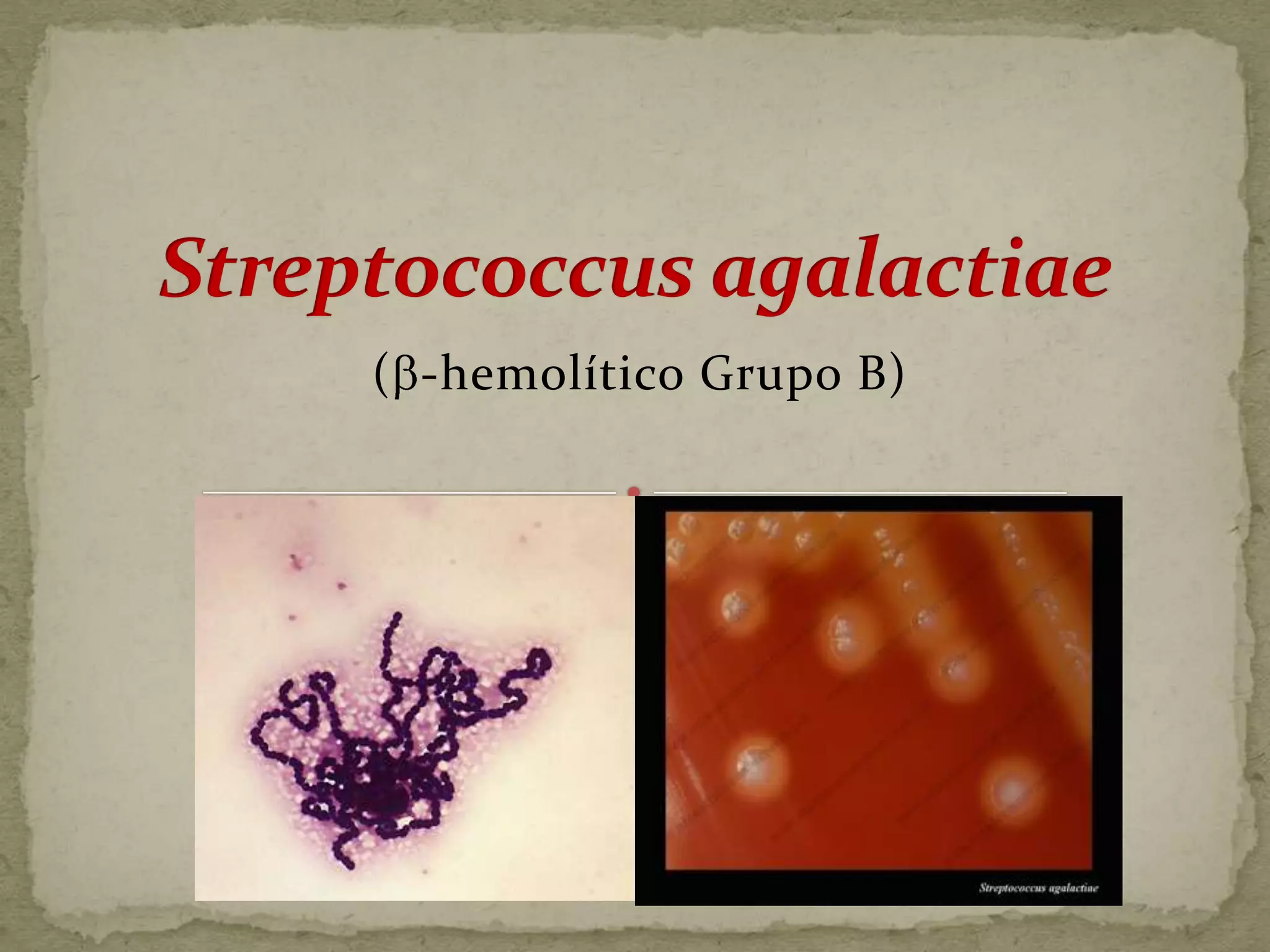 ( -hemolítico Grupo B)
 