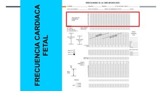 FRECUENCIA
CARDIACA
FETAL
 