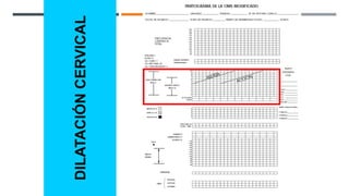 DILATACIÓN
CERVICAL
 