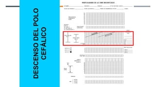 DESCENSO
DEL
POLO
CEFÁLICO
 
