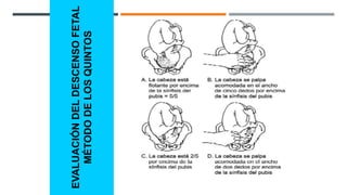 EVALUACIÓN
DEL
DESCENSO
FETAL
MÉTODO
DE
LOS
QUINTOS
 