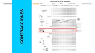CONTRACCIONES
 
