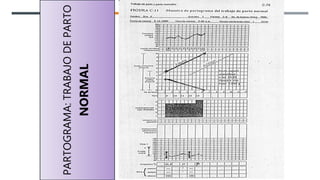 PARTOGRAMA:
TRABAJO
DE
PARTO
NORMAL
 