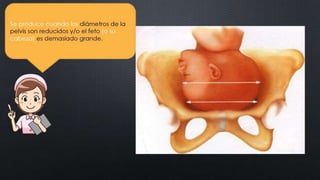 CLASE_8_PARTOGRAMA_DR_ALCANTARA.pptx