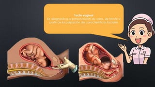 CLASE_8_PARTOGRAMA_DR_ALCANTARA.pptx