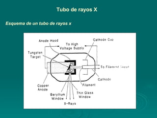 Tubo de rayos X Esquema de un tubo de rayos x 